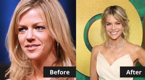 Kaitlin Olson Botox And Face Lift: Before And After。